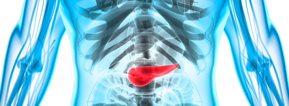 pancreatitis-4
